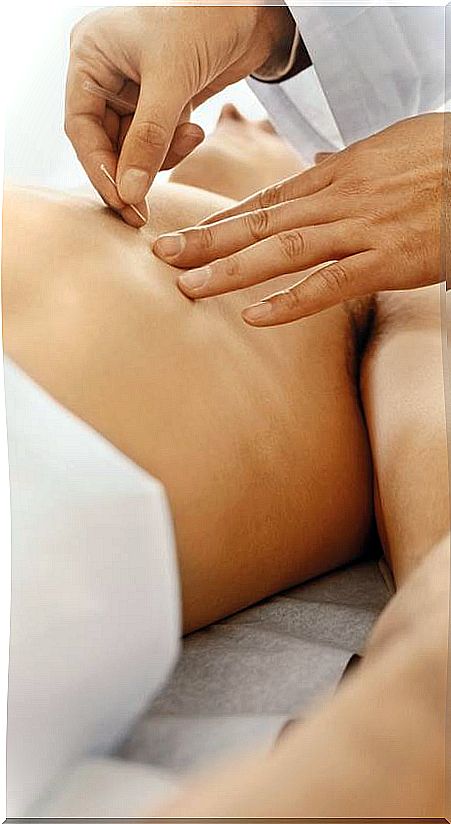 Acupuncture in abdomen